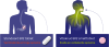 B12 5000 mcg Methylcobalamine